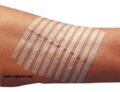 PHARMASTRIPS 4MM X 76MM VOIR AUTRES DIMENSIONS