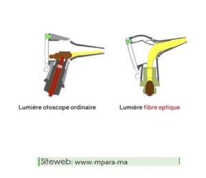 Otoscope fibre optique