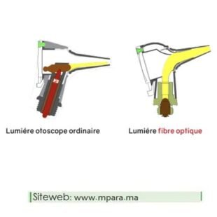 Otoscope fibre optique